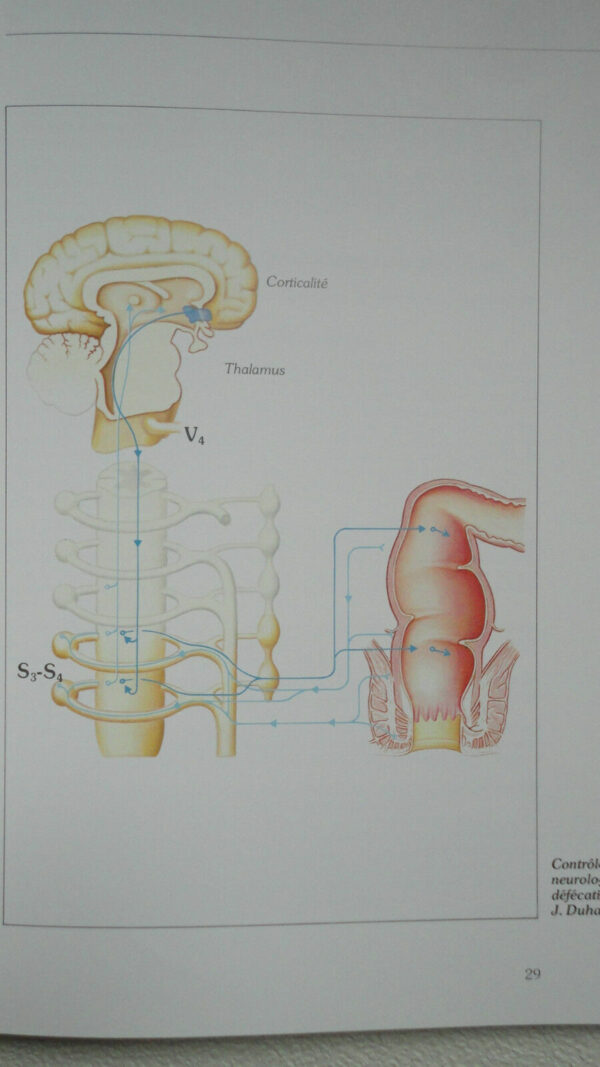 constipation Guide pratique de la constipation – Image 4